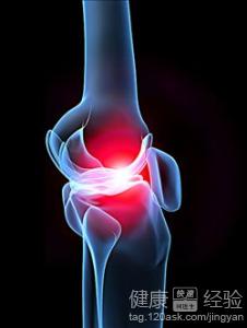 雙腿乏力難控你的腿怎麼了?