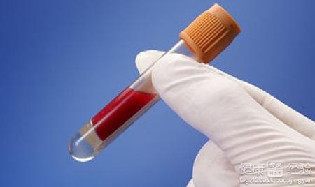 高脂血症吃什麼好