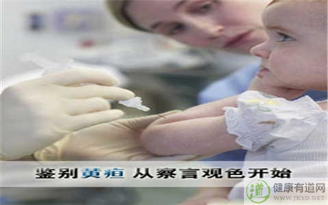 黃疸是什麼 黃疸是什麼