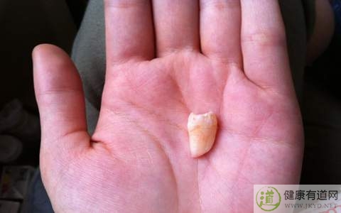 拔牙的危害 拔牙的危害