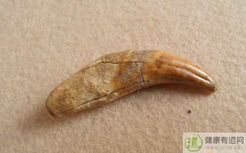 長蟲牙了怎麼辦 長蟲牙了怎麼辦